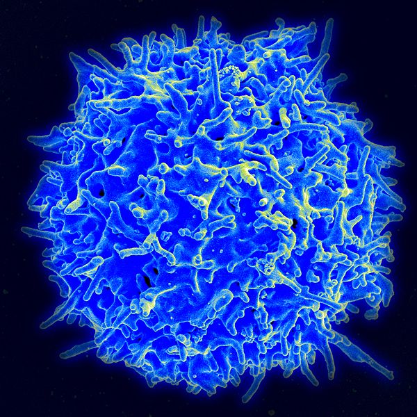 A scanning electron microscope image of a healthy human T cell. (From http://en.wikipedia.org/wiki/T-cell)