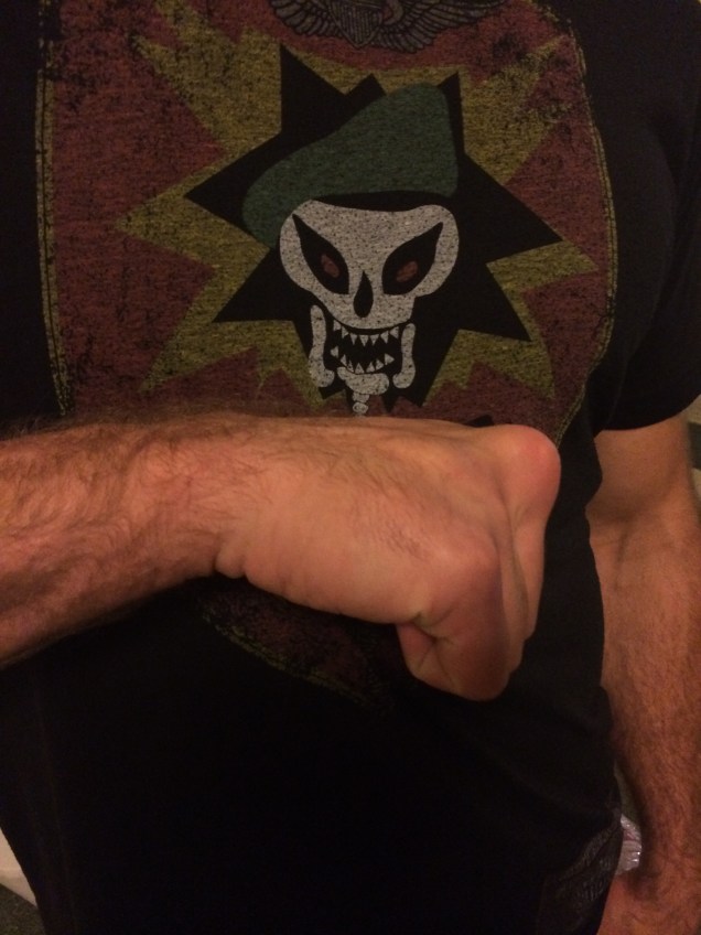 One for my paleopathology friends! Ryan Jensen has the best boxer's knuckles I've ever seen. 